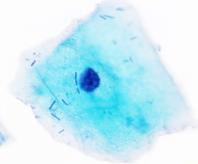 Normal Vaginal Flora on Pap Stain