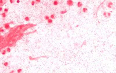 Haemophilus Influenzae Sputum 1000x