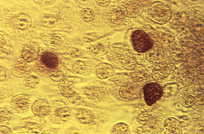 Chlamydia trachomatis