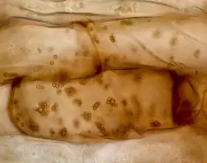 Amaranthus Viridis Root Cells Host Endophytic Bacterium Pseudomonas