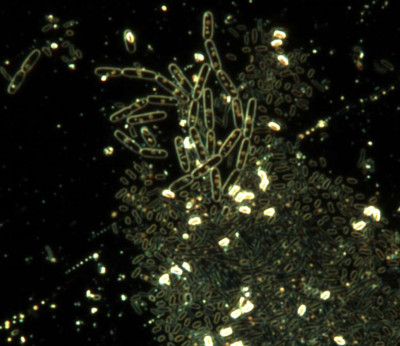 Spores of Bacillus subtilis