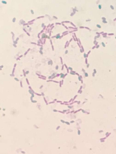 Stained Bacillus Subtilis