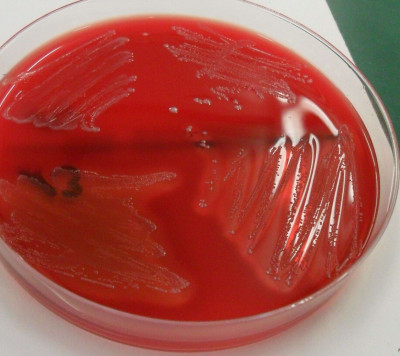 Streptococcus pyogenes and Enterokokken