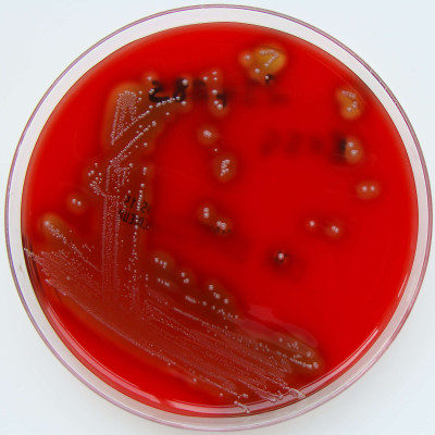 Streptococcus pyogenes (Lancefield Group A) on Columbia Horse Blood Agar