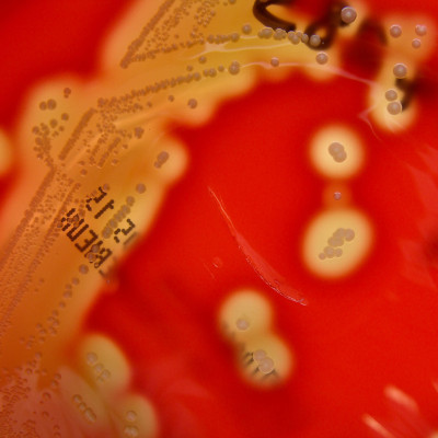 Streptococcus pyogenes (Lancefield Group A) on Columbia Horse Blood Agar