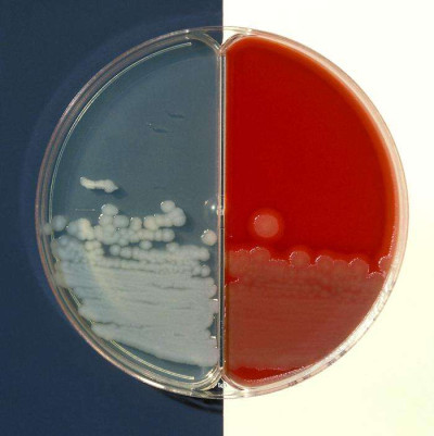 Blood Agar and Bicarbonate Agar Plate Cultures of Bacillus Cereus