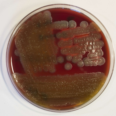 Bacillus cereus Columbia-Blutagar