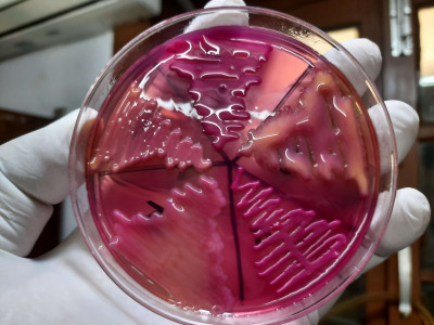 Variety of Klebsiella Colony Morphology