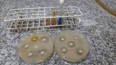 Klebsiella pneumonaie Biochemical Tests and Antibiogram