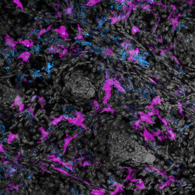 Immune Cells Surrounding Hair Follicles in Mouse Skin