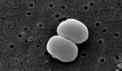 Staphylococcus Epidermidis lores