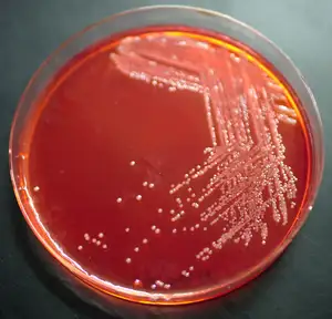 Yersinia hibernica