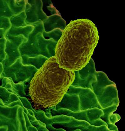 Klebsiella pneumonia Bacterium