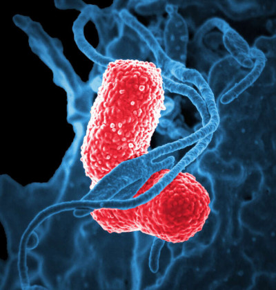 Multidrug-Resistant Klebsiella pneumoniae and Neutrophil