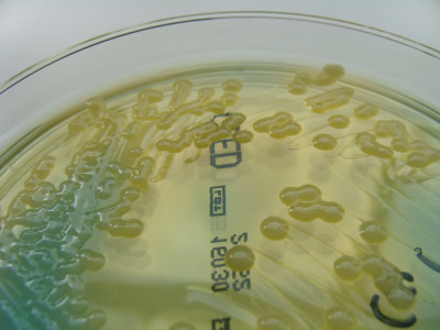 Klebsiella pneumoniae on CLED Agar