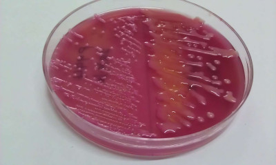 Escherichia coli vs Klebsiella pneumoniae