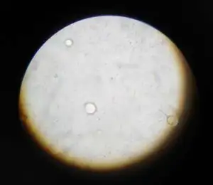 Clostridium tetani in Culture Medium