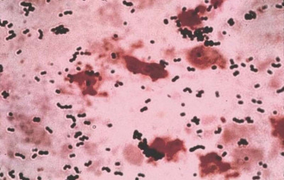 Streptococcus agalactiae