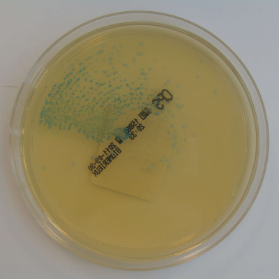 Streptococcus agalactiae on ChromID CPS Chromogenic Agar
