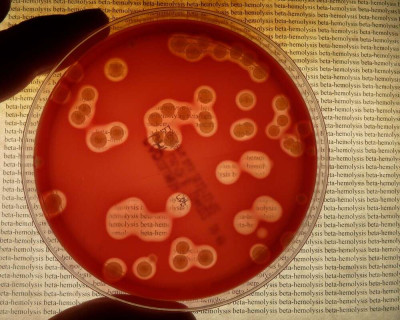 Beta Hemolysis on Blood Agar