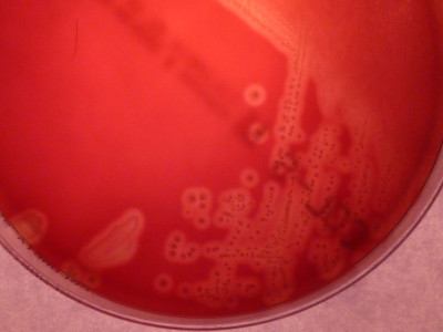 Streptococcus agalactiae on Blood Agar