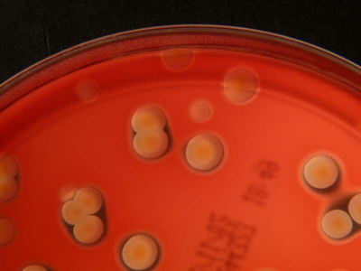 Staphylococcus aureus and Streptococcus agalactiae on Blood Agar