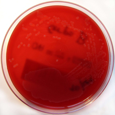 Streptococcus agalactiae on Columbia Horse Blood Agar