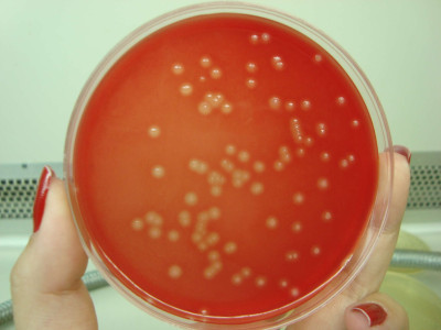 Streptococcus agalactiae