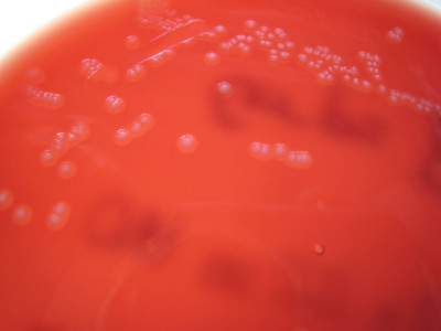 Streptococcus agalactiae on Columbia Horse Blood Agar