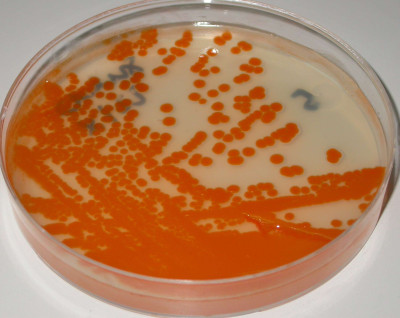 Streptococcus agalactiae on Granada Medium