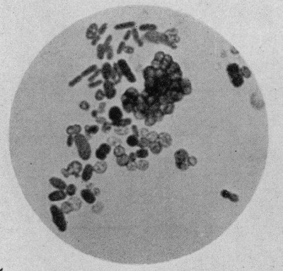 Azotobacter Cells