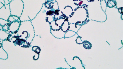 Heterocyst in Anaboena