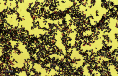 Corynebacterium pseudodiphteriae