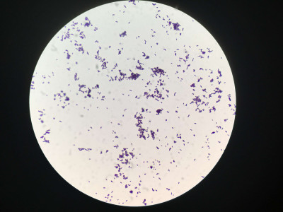 Corynebacterium