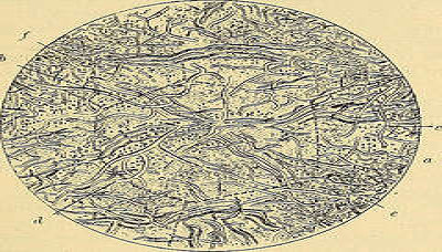 Corynebacterium minutissimum