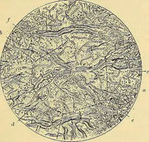 Corynebacterium minutissimum