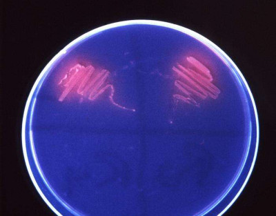Petri Dish with Corynebacterium minutissimum (UV Light)