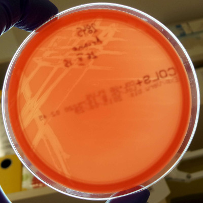 Arcanobacterium haemolyticum after 24 Hours