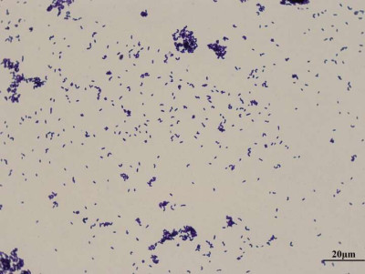 Corynebacterium xerosis Gram Stain