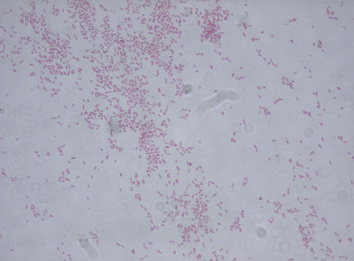 Citrobacter freundii Gram Stain