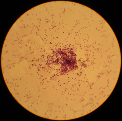 Lactococcus lactis