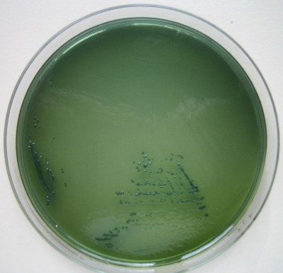 Vibrio parahaemolyticus
