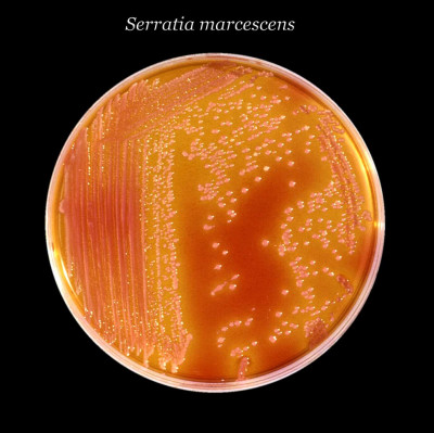 Serratia marcescens
