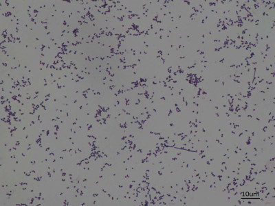 Nocardia in Gram Stain