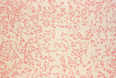 Yersinia enterocolitica Gram Stained