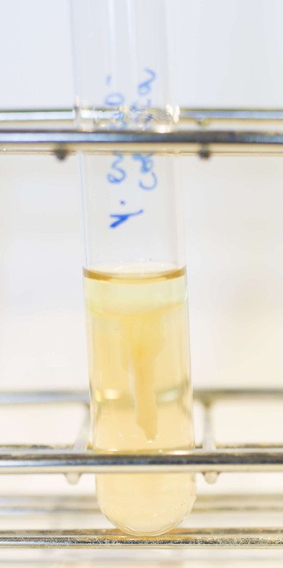 Yersinia enterocolitica in SIM Agar