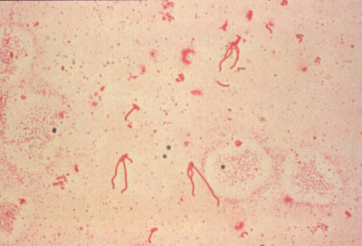 Yersinia enterocolitica flagella