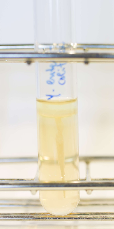 Yersinia enterocolitica in SIM Agar