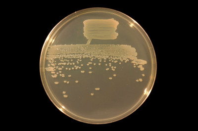 Pseudomonas fluorescens on TY Agar