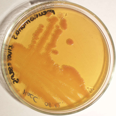 Pseudomonas fluorescens MacConkey Colonies